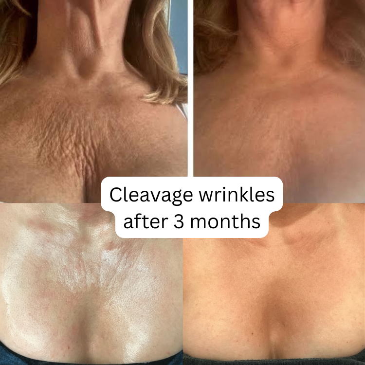 Bee Cream Neck