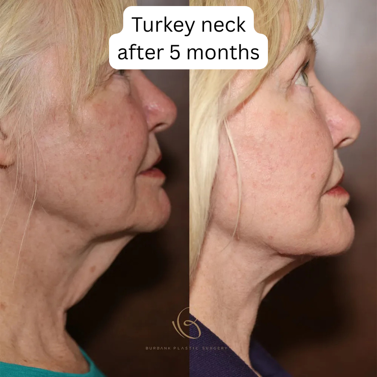 Bee Cream Neck