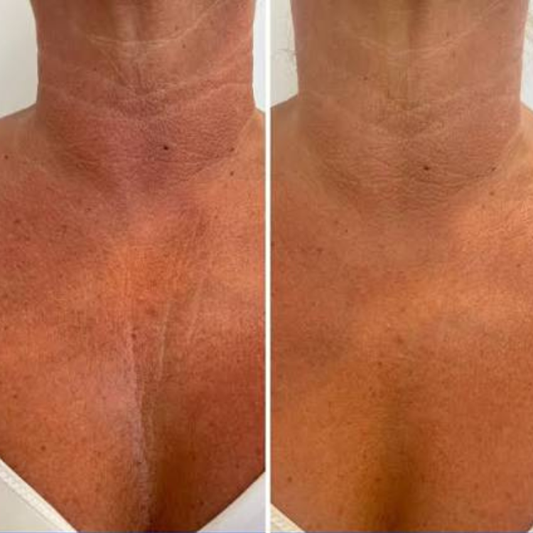 Bee Cream Neck