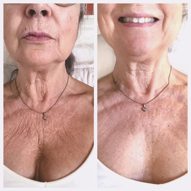 Bee Cream Neck